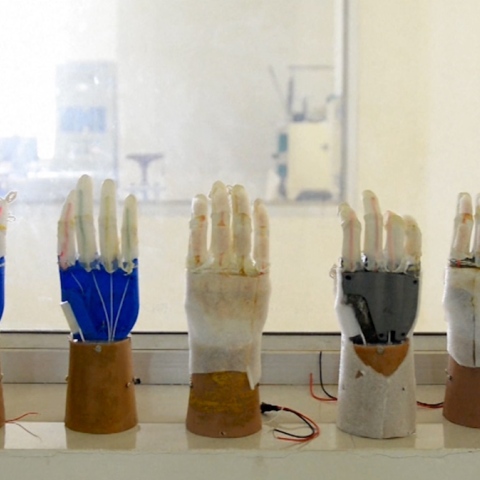 Photo: Cheap Artificial Limbs